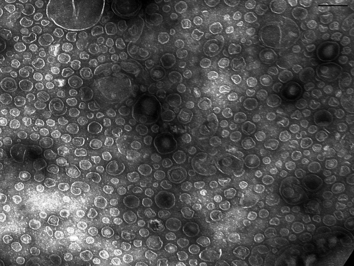 Фотография везикул Lysobacter sp. XL1, полученная методом просвечивающей электронной микроскопии / Ирина Кудрякова